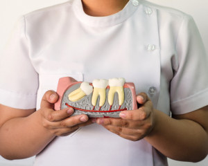 'wisdom teeth mold'